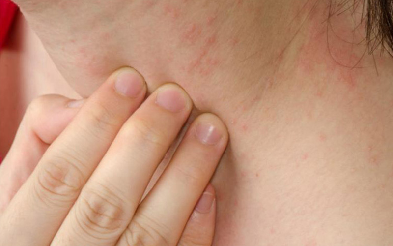 Không dùng sữa tắm trong thời gian dài gây nên cảm giác khó chịu, ngứa ngáy