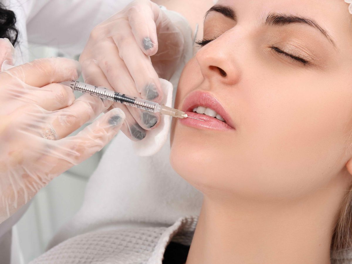 Nên thực hiện tiêm filler môi ở những nơi uy tín, có bác sĩ chuyên môn vững