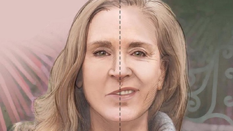 Tiêm botox gây méo mặt