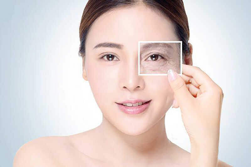 Tiêm botox giúp hạn chế tình trạng co giật mí mắt