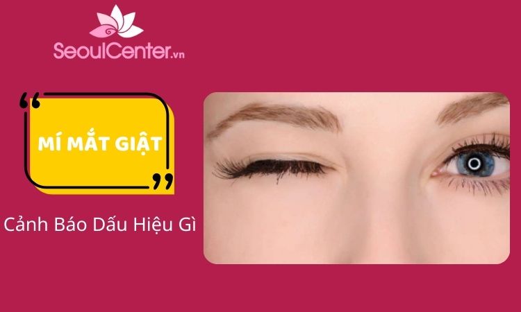 Mí mắt giật: Dấu hiệu cảnh báo điều gì