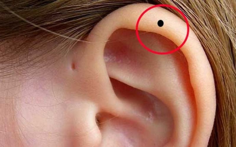 Nốt ruồi ở vành tai nữ biểu hiện của tài lộc, có nhiều may mắn Nốt ruồi ở vành tai nữ biểu hiện của tài lộc, có nhiều may mắn