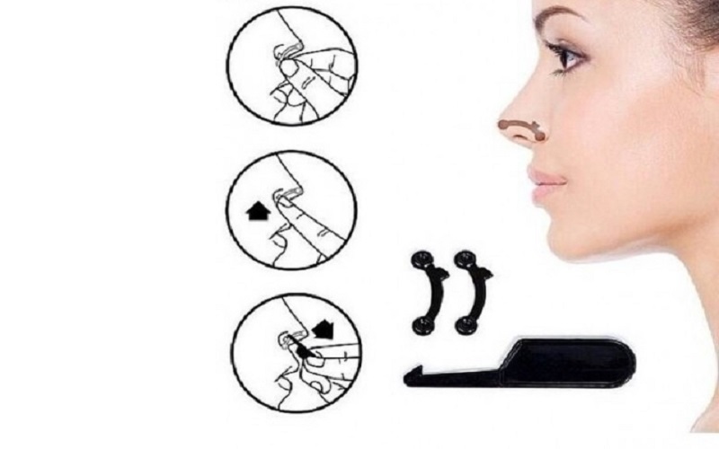 Dụng cụ nâng mũi giúp mũi cao hơn, hai bên mũi thon gọn
