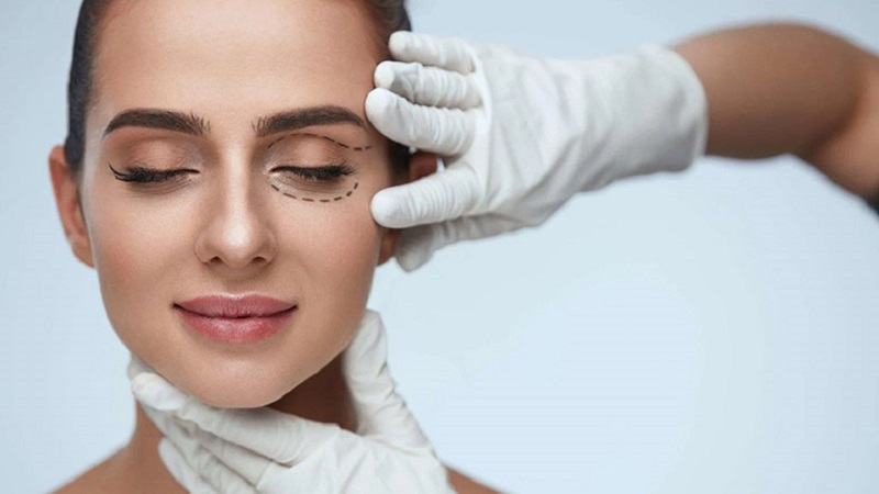 Tùy trường hợp cụ thể mới nên chỉnh sửa để có mắt long