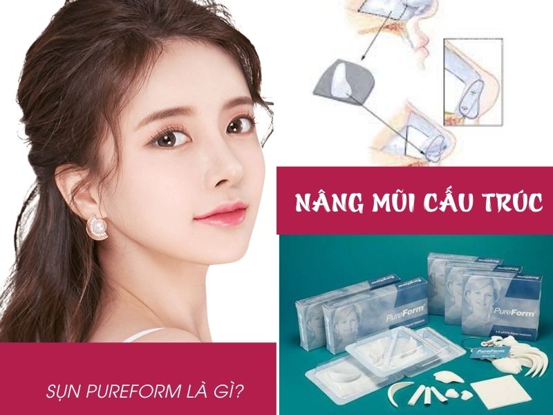 Nâng mũi cấu trúc Pureform