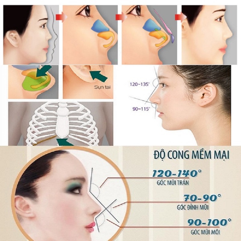 Kỹ thuật nâng mũi S Line cấu trúc thực hiện vô cùng tỉ mỉ và an toàn
