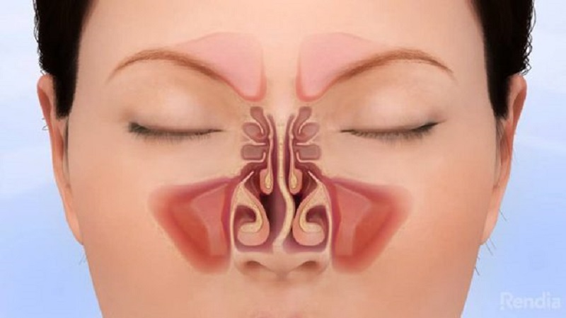 Có nhiều những nguyên nhân khác nhau khiến vách ngăn mũi ảnh hưởng