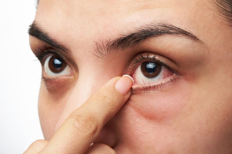 Mắt bạn bị khô và có cảm giác cộm, khó chịu