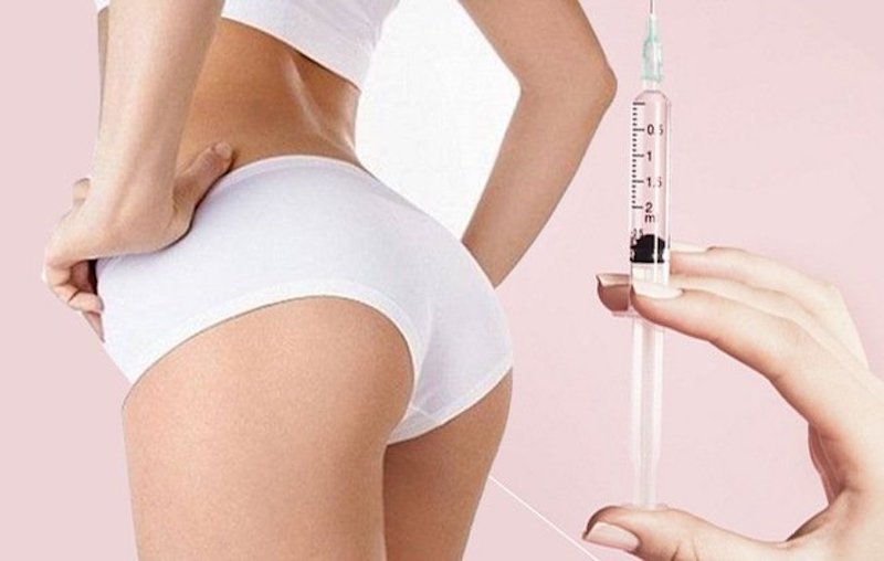 Dịch vụ tiêm Filler Mông - Giúp cặp mông căng tròn | Seoul Center