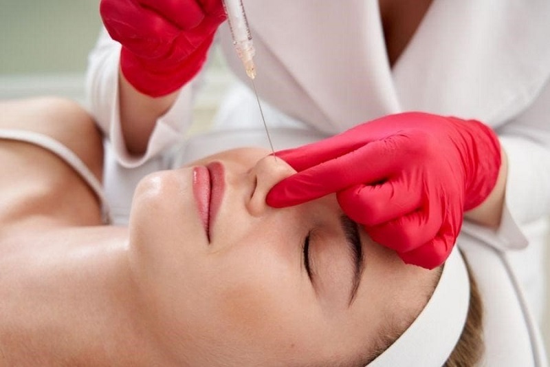 Để tránh biến chứng khi tiêm filler cần tìm hiểu filler đưa vào mũi Để tránh biến chứng khi tiêm filler cần tìm hiểu filler đưa vào mũi