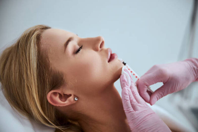 Chi phí thực hiện tiêm filler môi tự nhiên khoảng 5.000.000/1 cc Chi phí thực hiện tiêm filler môi tự nhiên khoảng 5.000.000/1 cc