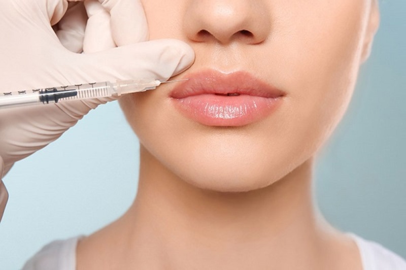 Tiêm filler bị chèn mạch dễ gây ra biến chứng, đột quỵ nguy hiểm Tiêm filler bị chèn mạch dễ gây ra biến chứng, đột quỵ nguy hiểm