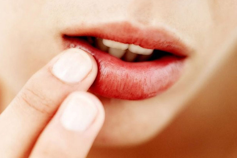 Nên tiêm filler môi tự nhiên ở những nơi uy tín để có được kết quả tốt, hạn chế biến chứng Nên tiêm filler môi tự nhiên ở những nơi uy tín để có được kết quả tốt, hạn chế biến chứng