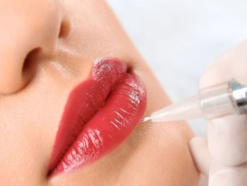 Cận cảnh quá trình tiêm môi bằng filler an toàn Cận cảnh quá trình tiêm môi bằng filler an toàn