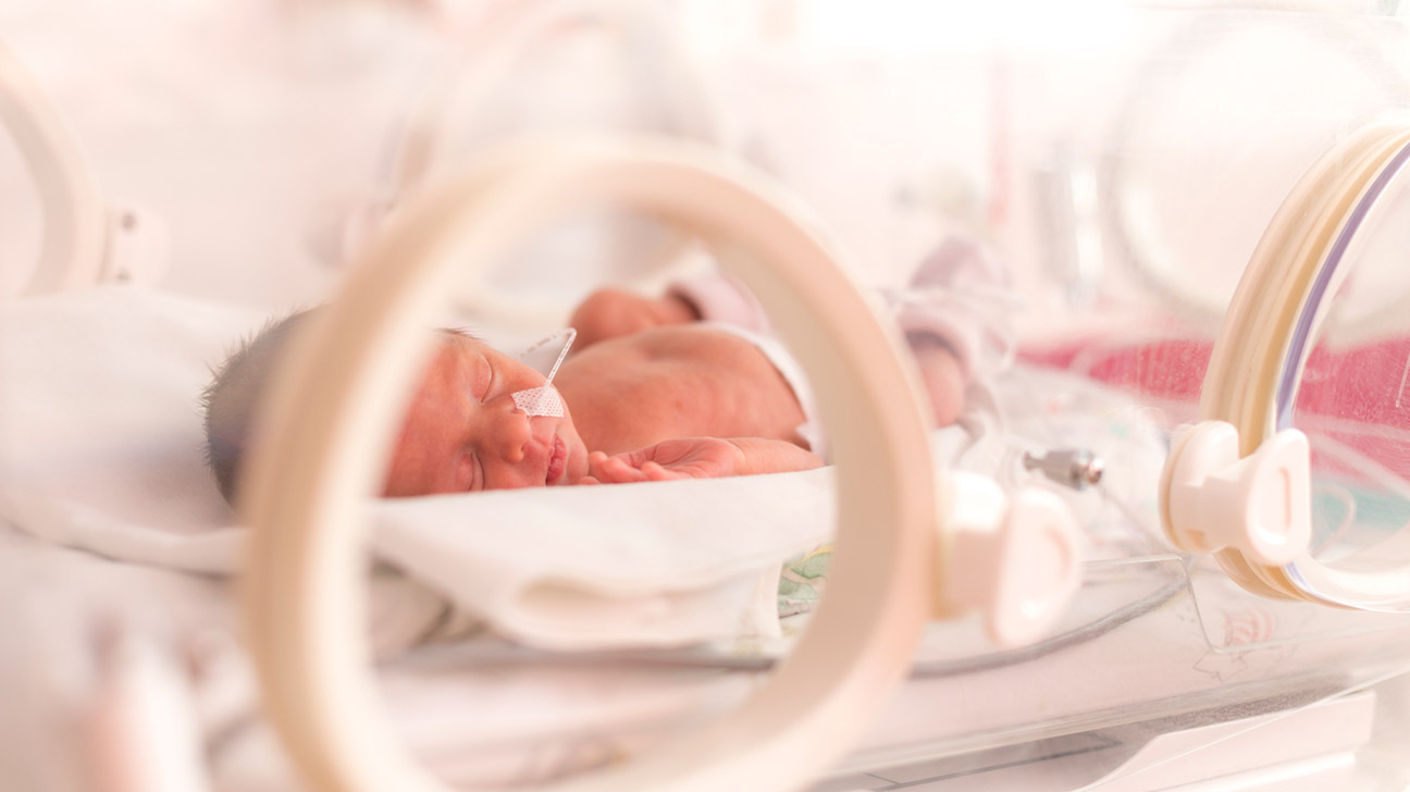 Các bé sinh non có tỷ lệ mắc màng thần kinh thị giác cao
