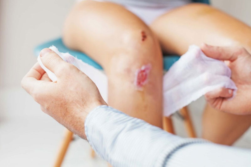 Vết thương dễ bị mưng mủ, sưng đau khi ăn mực hoặc hải sản