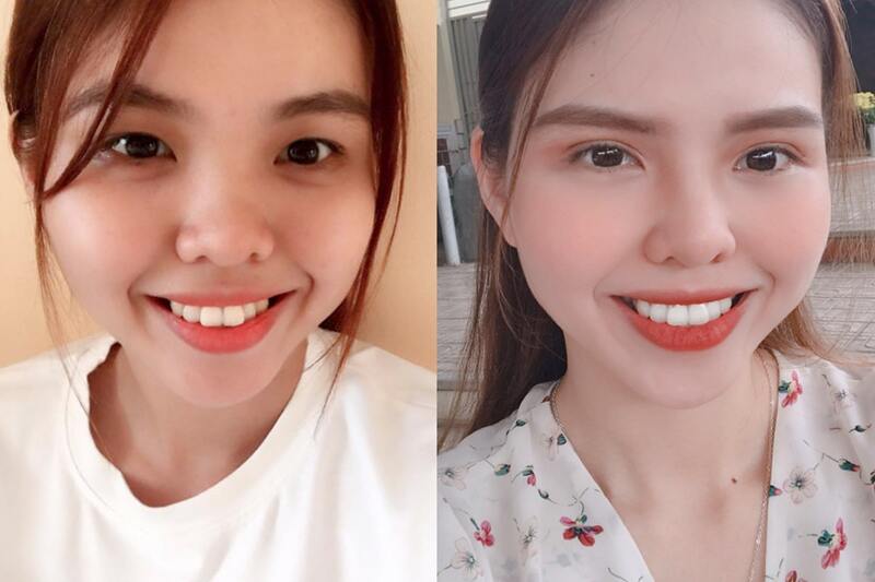 Các đường nét trở nên hài hòa và sắc sảo hơn sau khi tân trang lại đôi mắt