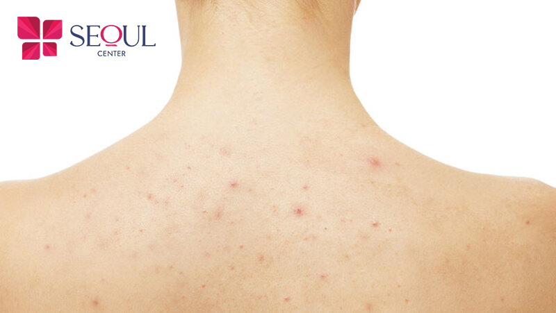 Tắm trắng phi thuyền bao nhiêu tiền