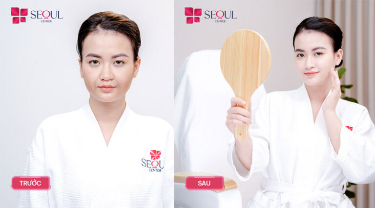 Dr.Young Neo Collagen Mặt