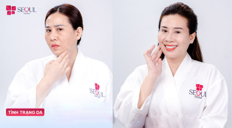 Dr.Young Neo Collagen Mặt