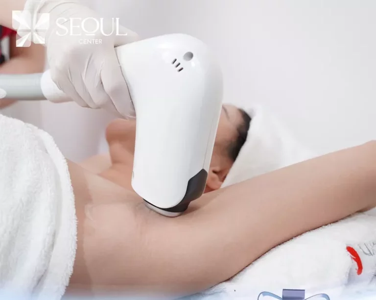 Áp dụng công nghệ triệt lông Diode Laser để triệt lông nách hiệu quả