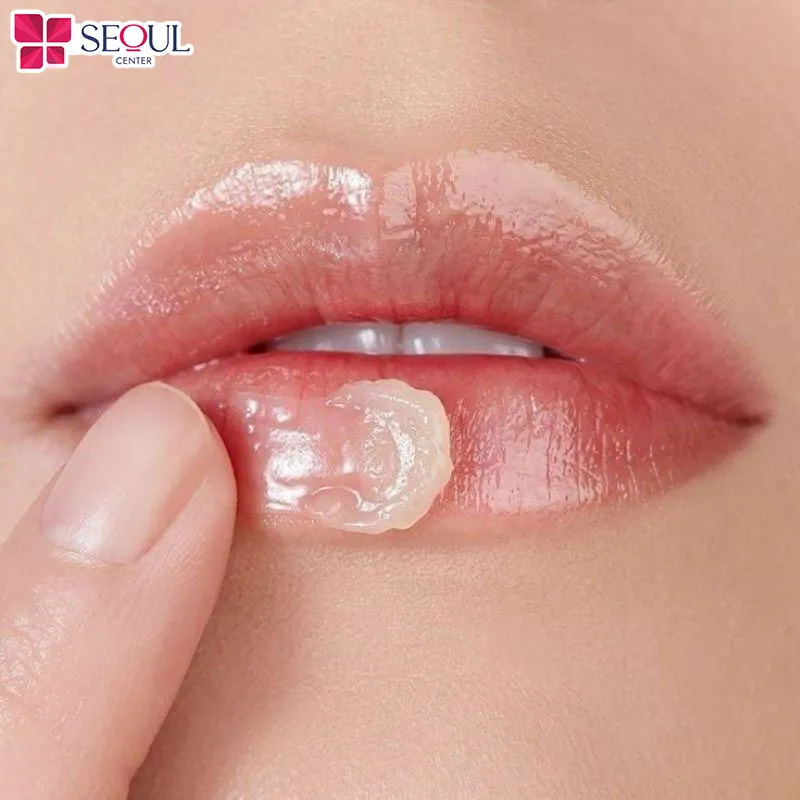 Thoa dưỡng môi thường xuyên để cấp ẩm cho môi giúp môi luôn mềm mịn