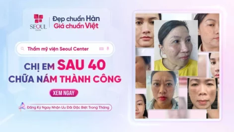Dứt Điểm Nỗi Ám Ảnh Nám Cho Chị Em Sau 40 Tại Seoul Center