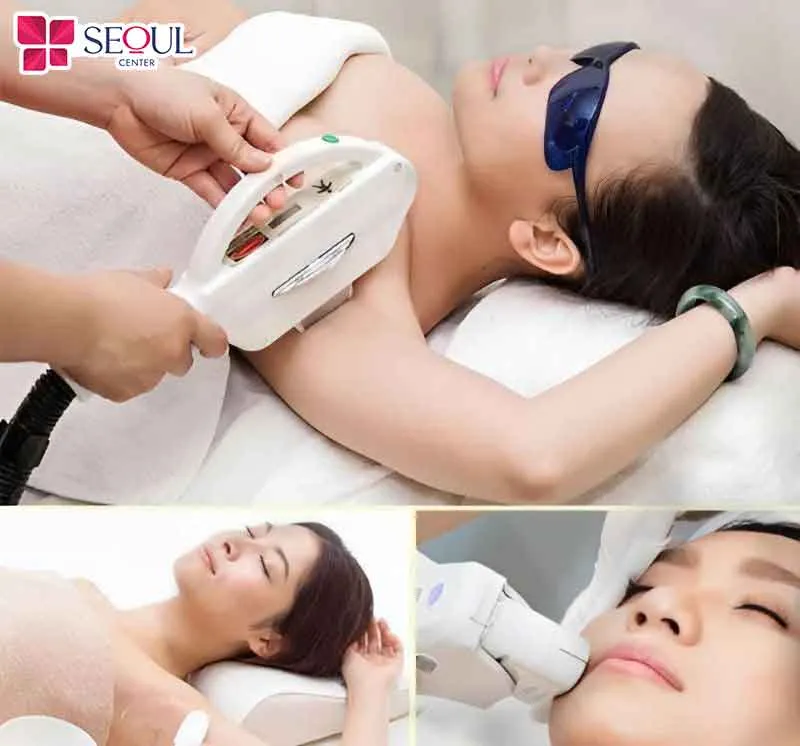 Loại bỏ những vùng lông mọc dày không mong muốn