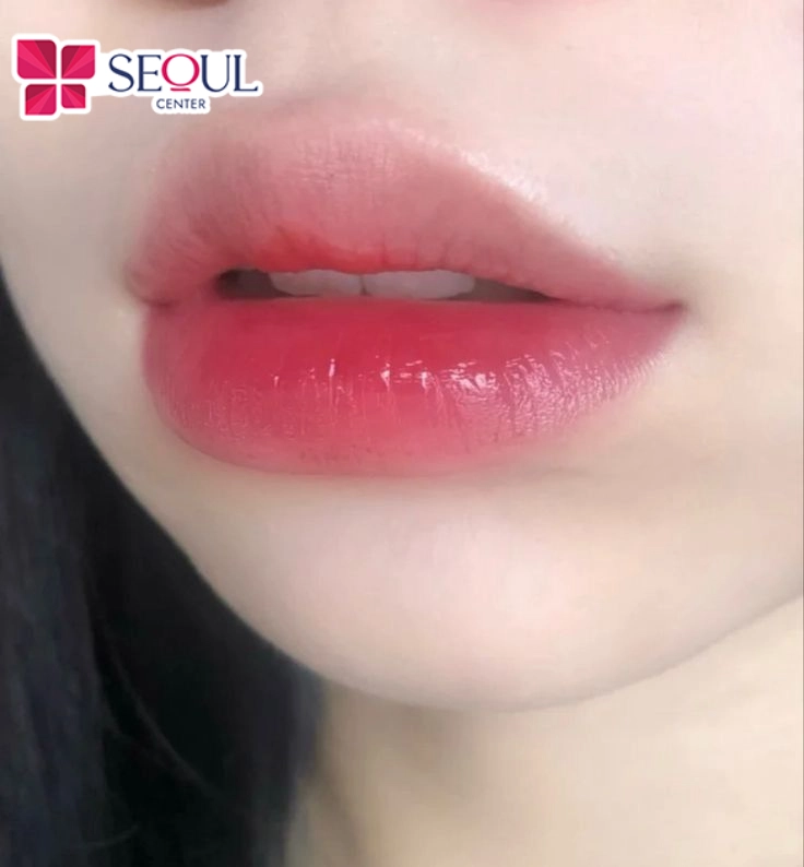 Phương pháp phun Baby Lips không tổn thương hay để lại sẹo cho môi 