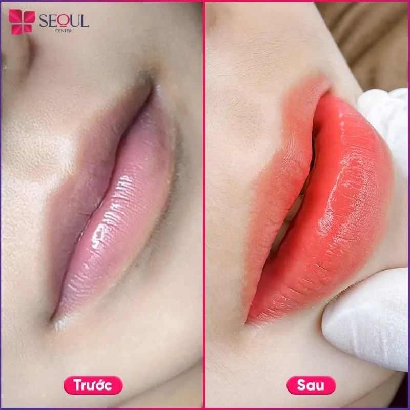 Đôi môi sau khi phun Baby Lips trở nên căng mọng tươi tắn