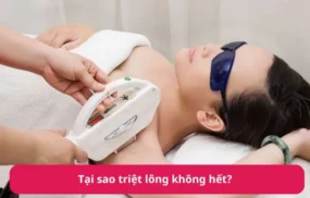 Tại sao triệt lông không hết