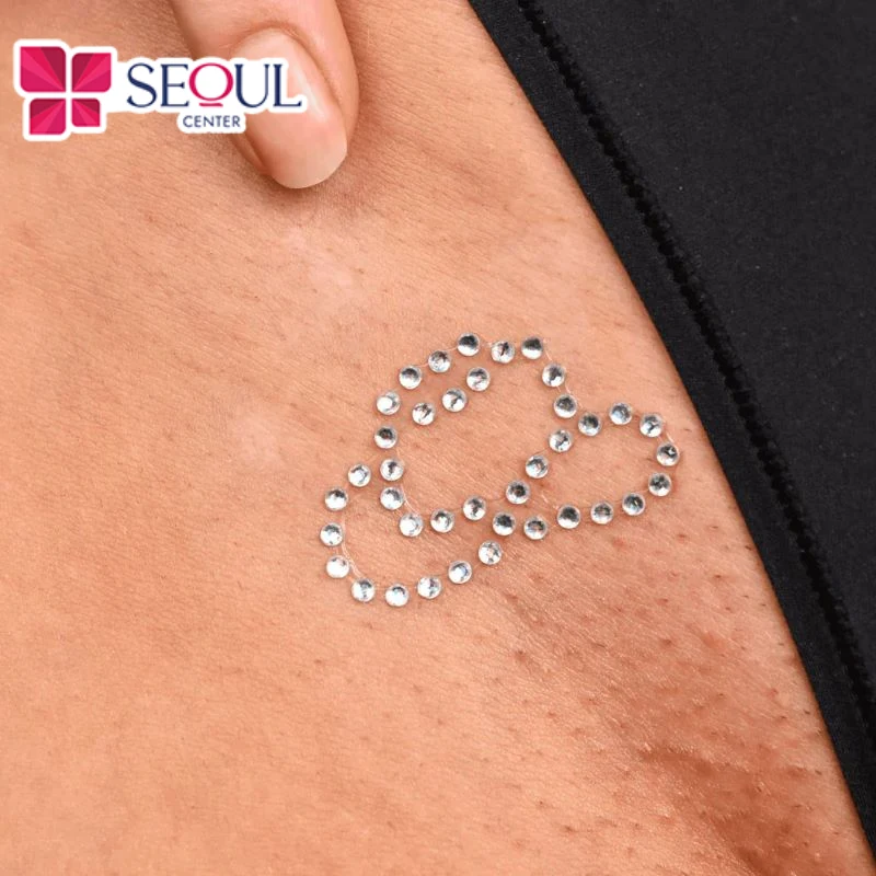 Triệt lông bikini kiểu Vajazzle là kiểu đính đá lên vùng kín mang lại vẻ đẹp độc đáo