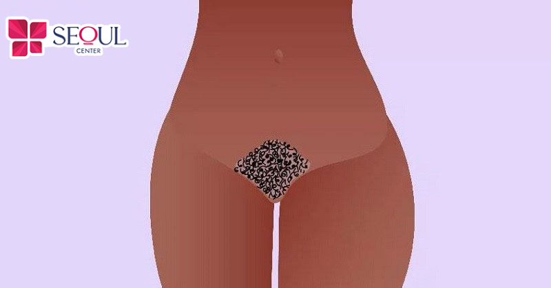 Tạo hình bikini kiểu bụi rậm sẽ không mất nhiều thời gian, cách thực hiện cũng đơn giản