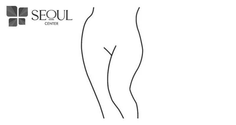 Tạo hình bikini Playboy là kiểu loại bỏ 100% lông vùng kín