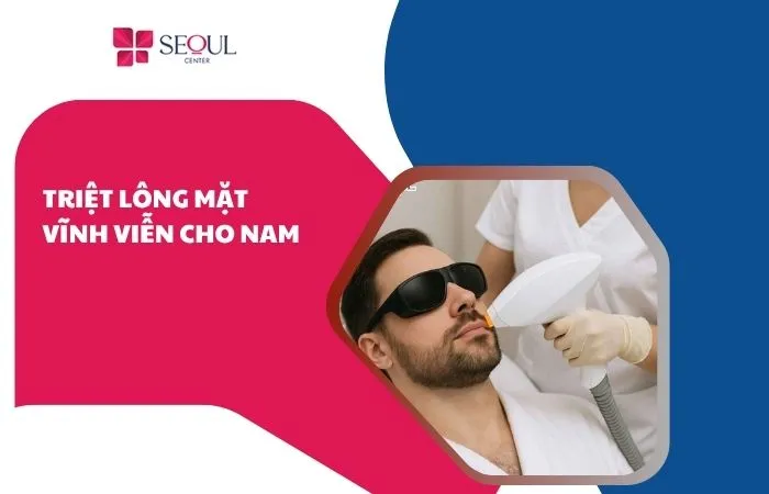 Triệt lông mặt vĩnh viễn cho nam