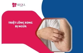 Triệt lông xong bị ngứa