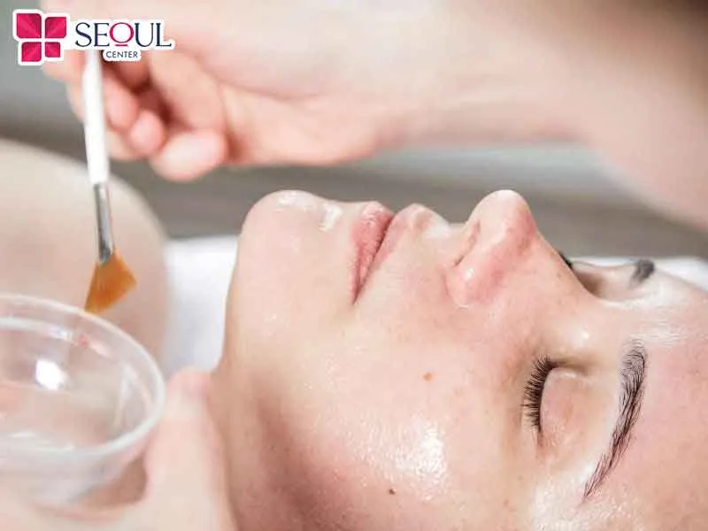Peel da hóa học là kỹ thuật cần thực hiện tại cơ sở uy tín để đảm bảo an toàn và hiệu quả