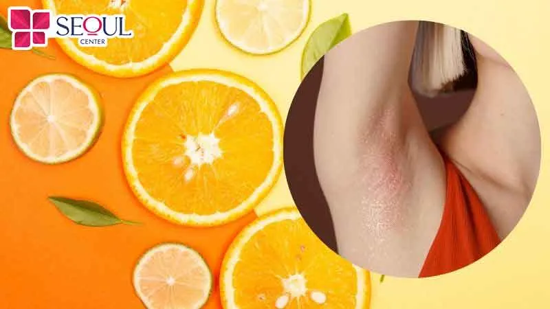 Chanh có chứa nhiều thành phần giúp suy yếu nang lông, làm lông dễ rụng và mềm hơn
