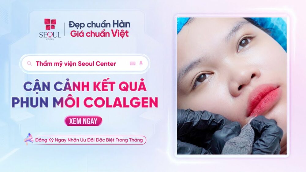 Xem Cận Cảnh: Từng Bước Phun Môi Collagen – Kết Quả Khiến Khách Hàng Phải Wow!