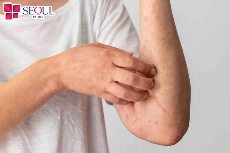 Nên tham khảo ý kiến của bác sĩ chuyên khoa da liễu trước khi thực hiện triệt lông