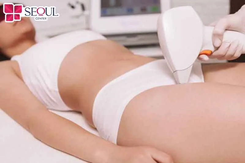 Triệt lông bằng công nghệ hiện đại sẽ hạn chế lông mọc ngược
