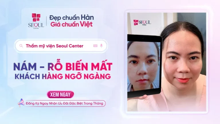 Nám, Sẹo Rỗ Biến Mất – Khách Hàng Ngỡ Ngàng Với Liệu Trình Tại Seoul Center!