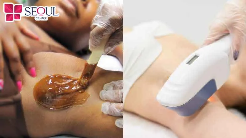 Nên wax hay triệt lông vĩnh viễn