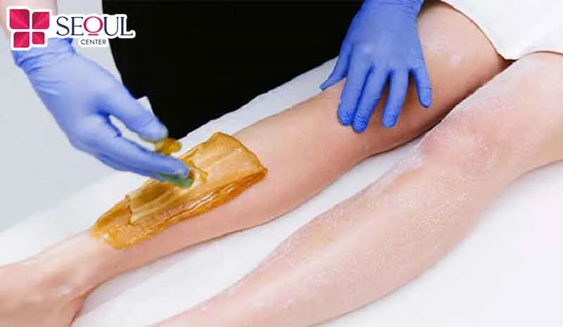 Wax lông là phương pháp loại bỏ lông bằng cách sử dụng sáp nóng hoặc sáp lạnh