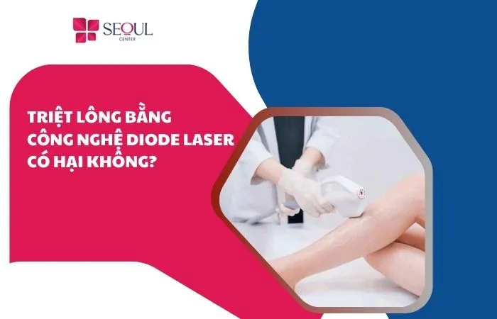 Triệt lông bằng công nghệ diode laser có hại không