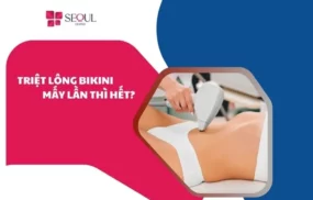 Triệt lông bikini mấy lần thì hết
