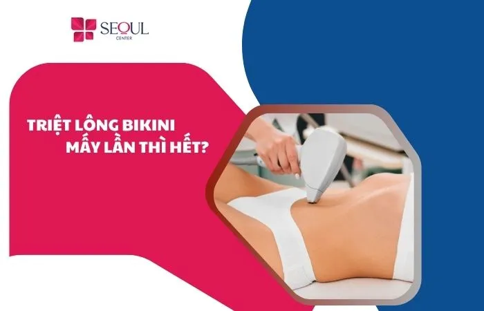 Triệt lông bikini mấy lần thì hết