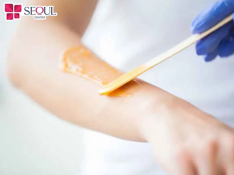 Sử dụng gel lạnh có thành phần từ thiên nhiên để hỗ trợ loại bỏ lông tận gốc