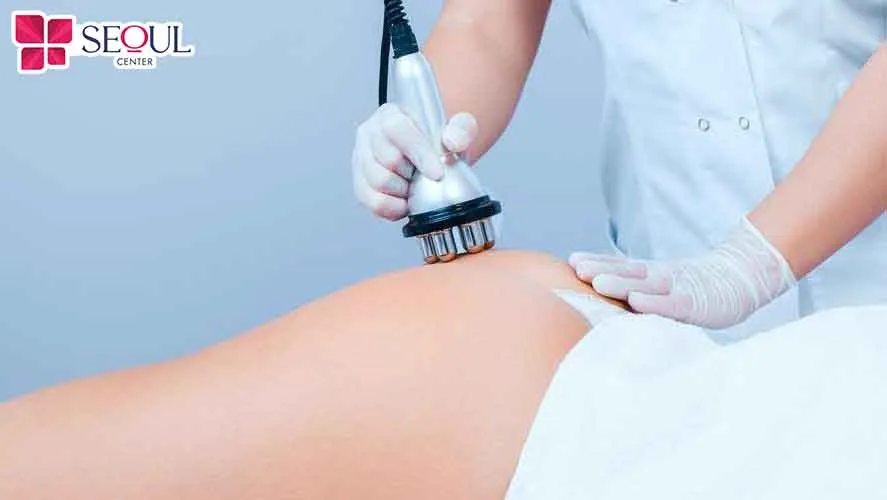 Nếu bạn nhận thấy lông hậu môn đang gây nhiều phiền toái dành cho bạn thì nên triệt lông 