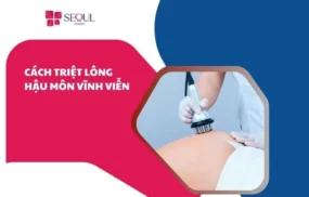 Triệt lông hậu môn vĩnh viễn